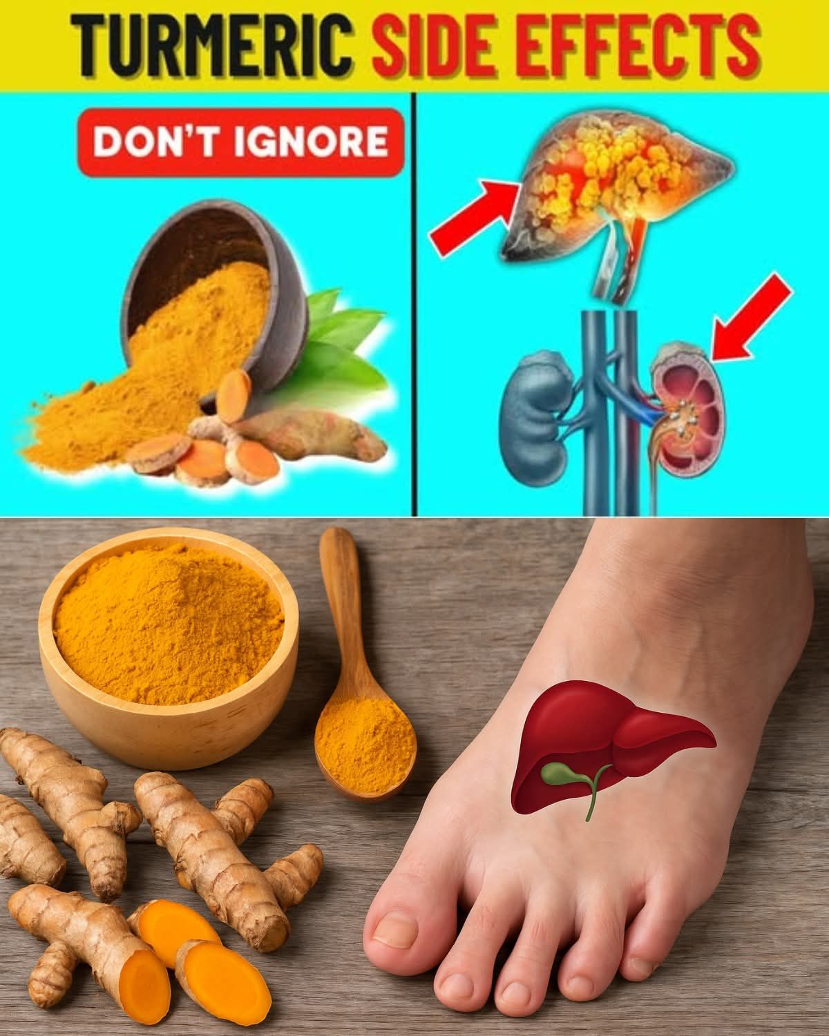 10 Surprising Things You Should Know Before Taking Turmeric Every Day