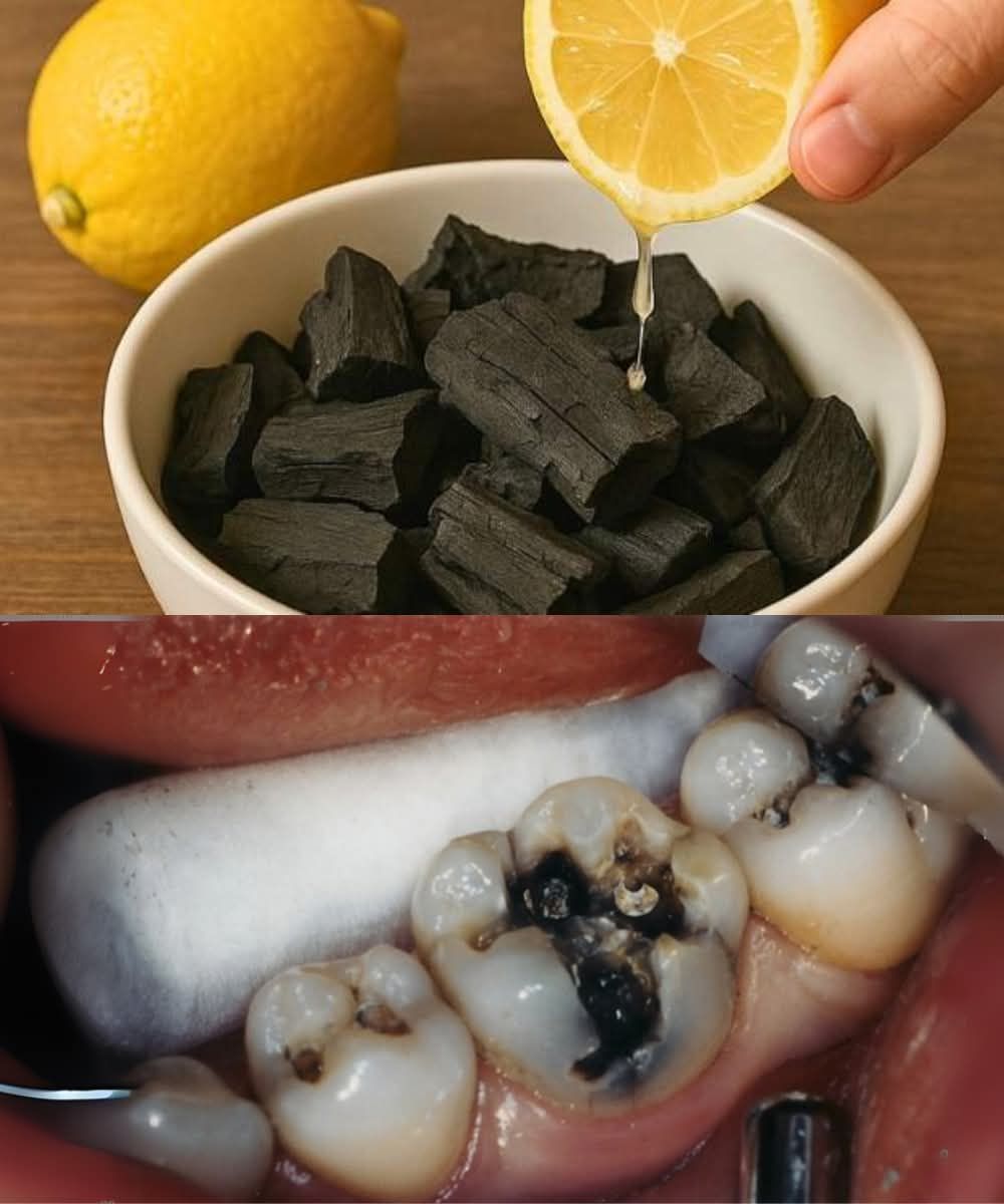 Natural Ways to Protect and Repair Your Teeth