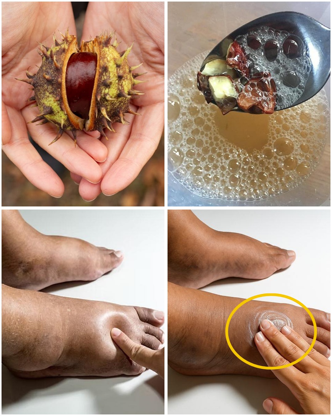 Horse Chestnut: The Strongest Natural Remedy for Swollen Legs and More…