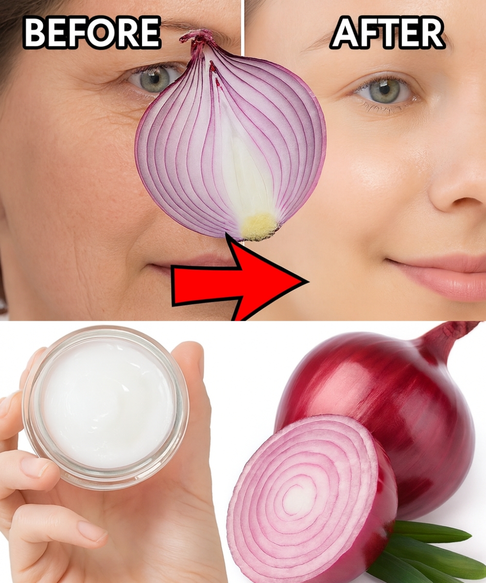 Erase Wrinkles Naturally With This Surprising Onion Remedy (Works Better Than You Think!)
