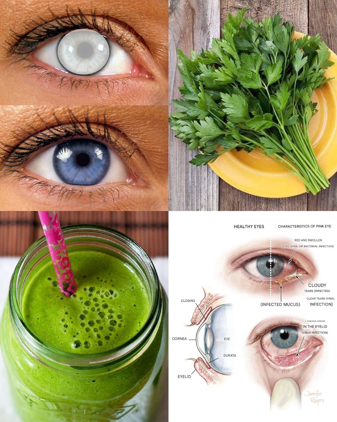 👁️💚 I Was Losing My Vision… Until Parsley Juice Changed Everything 🌿✨