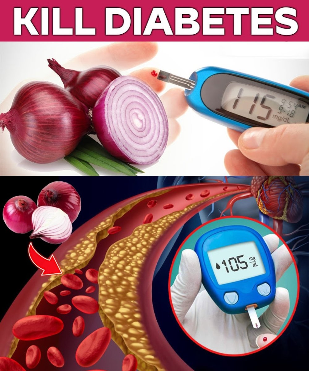 🧅 Instantly Lower Blood Sugar with This Purple Onion Recipe! A Hidden Kitchen Treasure