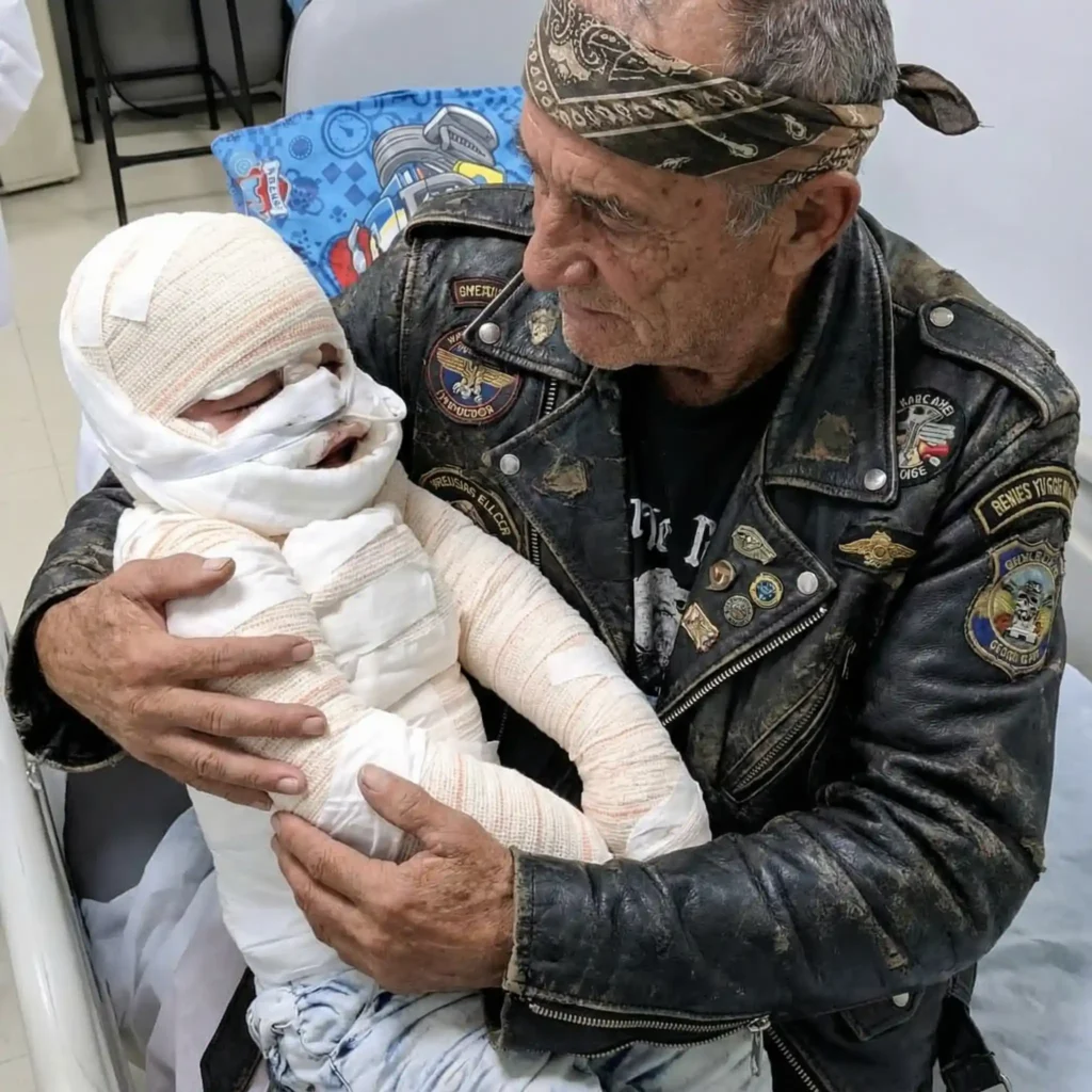 I Was Going to Abandon My Burned Baby — Until a Biker I’d Never Met Held Him and Said 6 Words