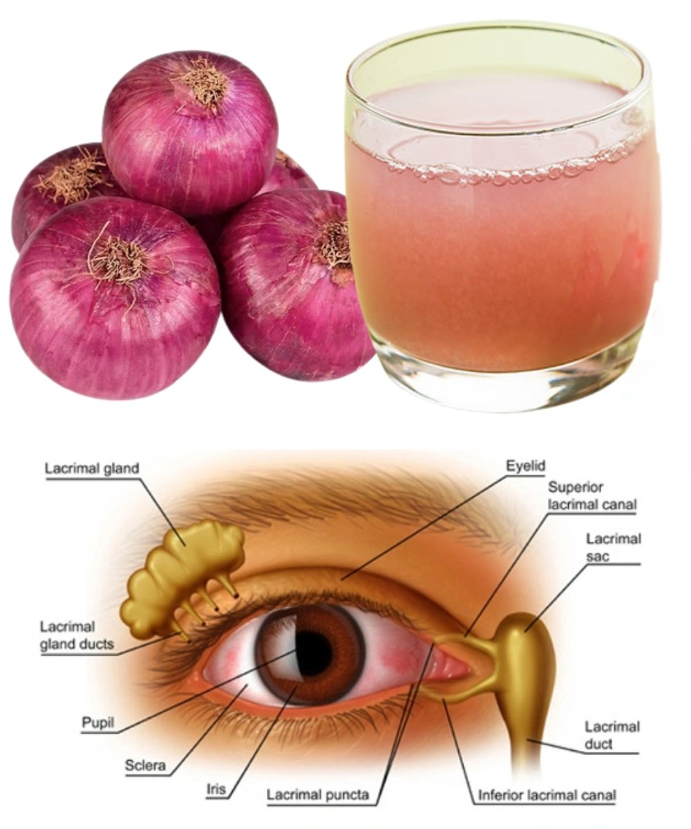 👁️ Can Onion Juice Gently Support Eye Health? A Natural Tip Worth Trying
